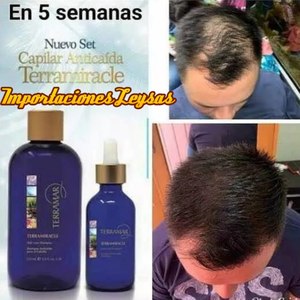 SET TERRAMIRACLE HAIR LOSS TREATMENT BY TERRAMAR